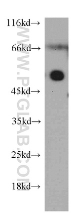 ZFYVE27 Antibody in Western Blot (WB)