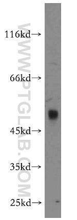 ZFYVE27 Antibody in Western Blot (WB)