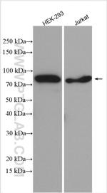 MUM1 Antibody in Western Blot (WB)