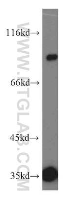 MUM1 Antibody in Western Blot (WB)