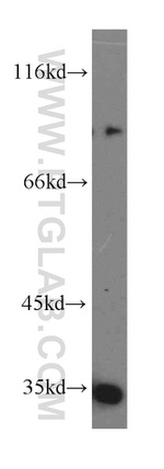 MUM1 Antibody in Western Blot (WB)