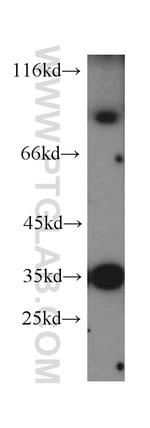 MUM1 Antibody in Western Blot (WB)