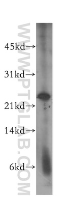 MAD2L2 Antibody in Western Blot (WB)