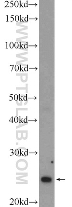 MAD2L2 Antibody in Western Blot (WB)