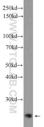 MAD2L2 Antibody in Western Blot (WB)