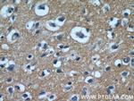 EAAT3 Antibody in Immunohistochemistry (Paraffin) (IHC (P))