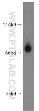 EAAT3 Antibody in Western Blot (WB)