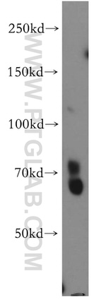 EAAT3 Antibody in Western Blot (WB)