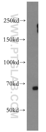 EAAT3 Antibody in Western Blot (WB)