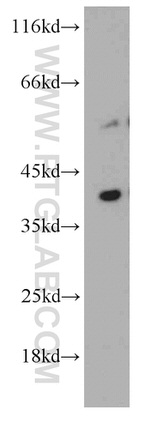 RFFL Antibody in Western Blot (WB)