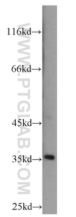 DPPA2 Antibody in Western Blot (WB)