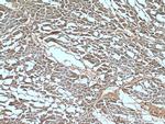 STK38L Antibody in Immunohistochemistry (Paraffin) (IHC (P))