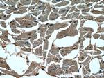 STK38L Antibody in Immunohistochemistry (Paraffin) (IHC (P))