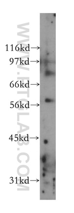 STK38L Antibody in Western Blot (WB)