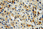 Kallikrein 11 Antibody in Immunohistochemistry (Paraffin) (IHC (P))