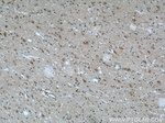 Kallikrein 11 Antibody in Immunohistochemistry (Paraffin) (IHC (P))