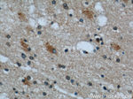 Kallikrein 11 Antibody in Immunohistochemistry (Paraffin) (IHC (P))