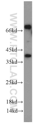 Kallikrein 11 Antibody in Western Blot (WB)