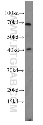 Kallikrein 11 Antibody in Western Blot (WB)