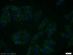 SGK3 Antibody in Immunocytochemistry (ICC/IF)