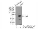 SGK3 Antibody in Immunoprecipitation (IP)