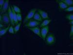 KIFAP3 Antibody in Immunocytochemistry (ICC/IF)