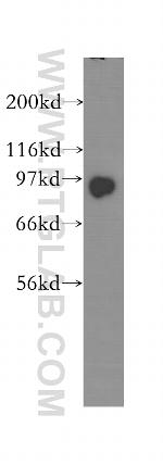 KIFAP3 Antibody in Western Blot (WB)