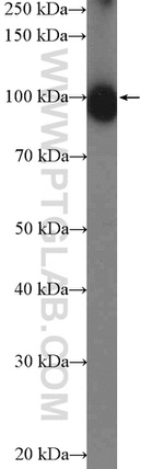 KIFAP3 Antibody in Western Blot (WB)