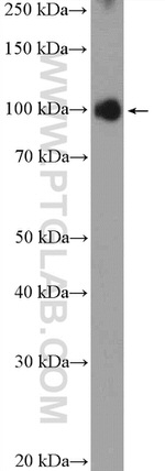 KIFAP3 Antibody in Western Blot (WB)