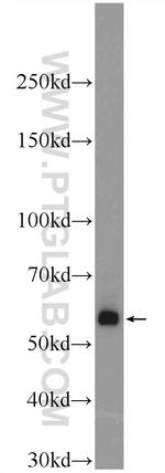 BMPR1A Antibody in Western Blot (WB)