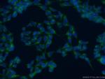 SNAP29 Antibody in Immunocytochemistry (ICC/IF)