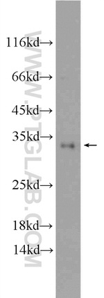 SNAP29 Antibody in Western Blot (WB)