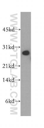 SNAP29 Antibody in Western Blot (WB)