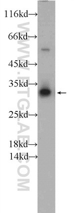 SNAP29 Antibody in Western Blot (WB)