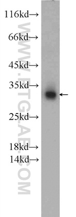 SNAP29 Antibody in Western Blot (WB)