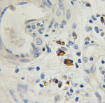 TRAM1 Antibody in Immunohistochemistry (Paraffin) (IHC (P))