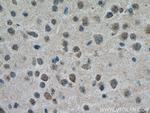 GABRA3 Antibody in Immunohistochemistry (Paraffin) (IHC (P))