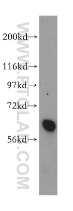 TROVE2 Antibody in Western Blot (WB)