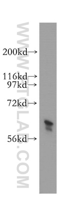 TROVE2 Antibody in Western Blot (WB)