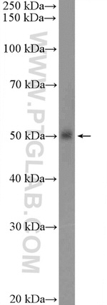 TROVE2 Antibody in Western Blot (WB)