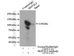 SKIV2L2 Antibody in Immunoprecipitation (IP)