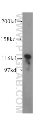 SKIV2L2 Antibody in Western Blot (WB)
