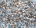 SLP76 Antibody in Immunohistochemistry (Paraffin) (IHC (P))