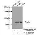 SLP76 Antibody in Immunoprecipitation (IP)
