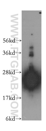 LIN7B Antibody in Western Blot (WB)