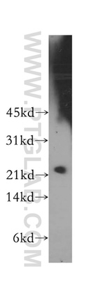 LIN7B Antibody in Western Blot (WB)