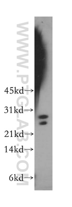 LIN7B Antibody in Western Blot (WB)