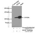 EIF3C Antibody in Immunoprecipitation (IP)