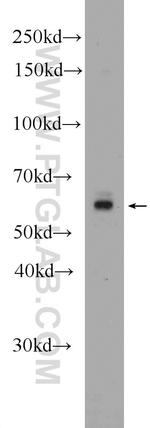 RabGEF1 Antibody in Western Blot (WB)