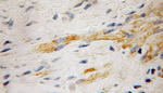 RabGEF1 Antibody in Immunohistochemistry (Paraffin) (IHC (P))